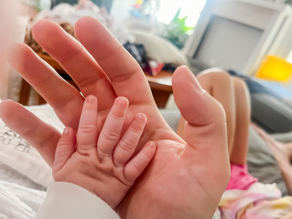 I had never seen her hand casually opened before. Up until her ties were revised her hands had been in tight fists and impossible to get her to relax them. This was a few hours after the procedure. 